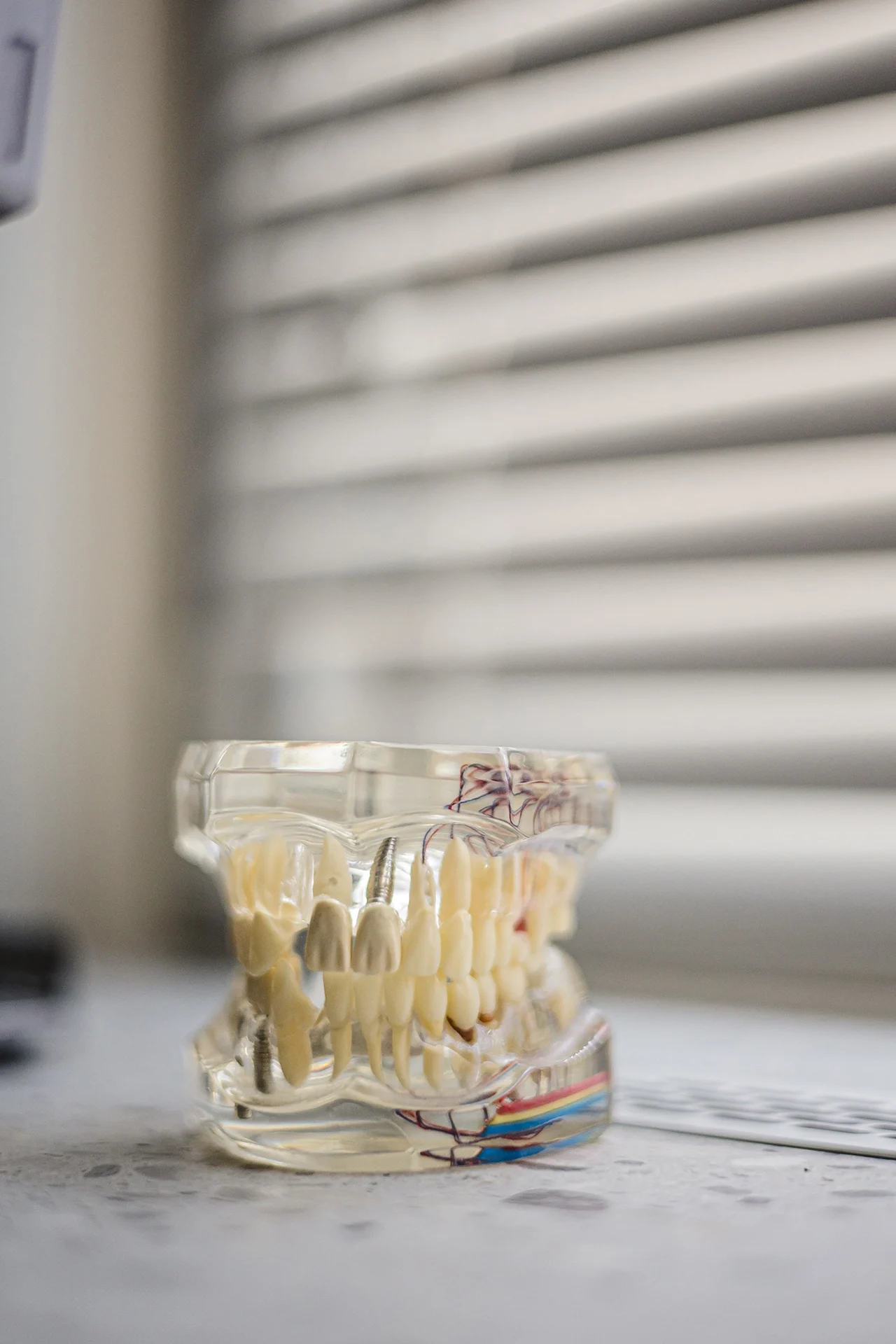 Skaidrus žandikaulio modelis su dantų implantais ir nervų sistema – naudojamas implantacijos planavimui